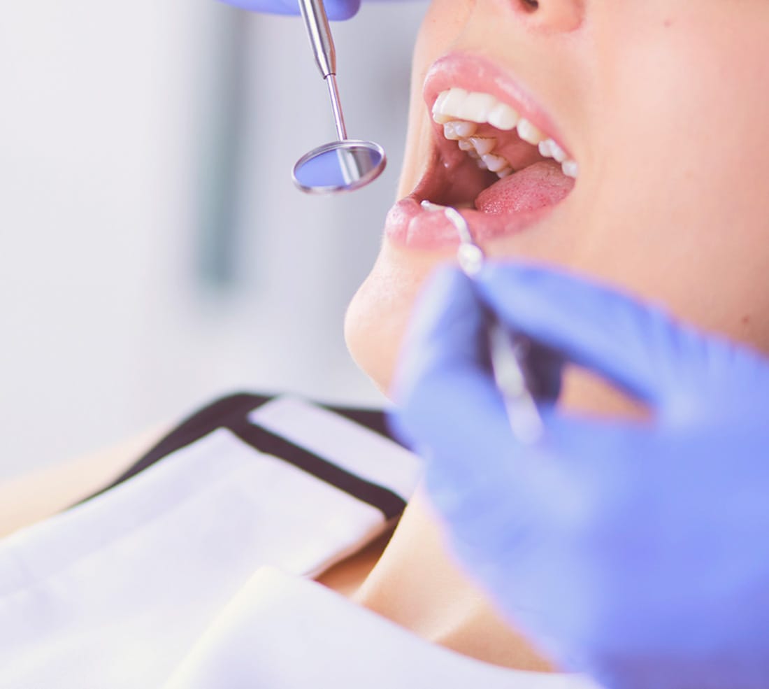 口腔環境の健康を維持する検査 口腔コンディションを整える