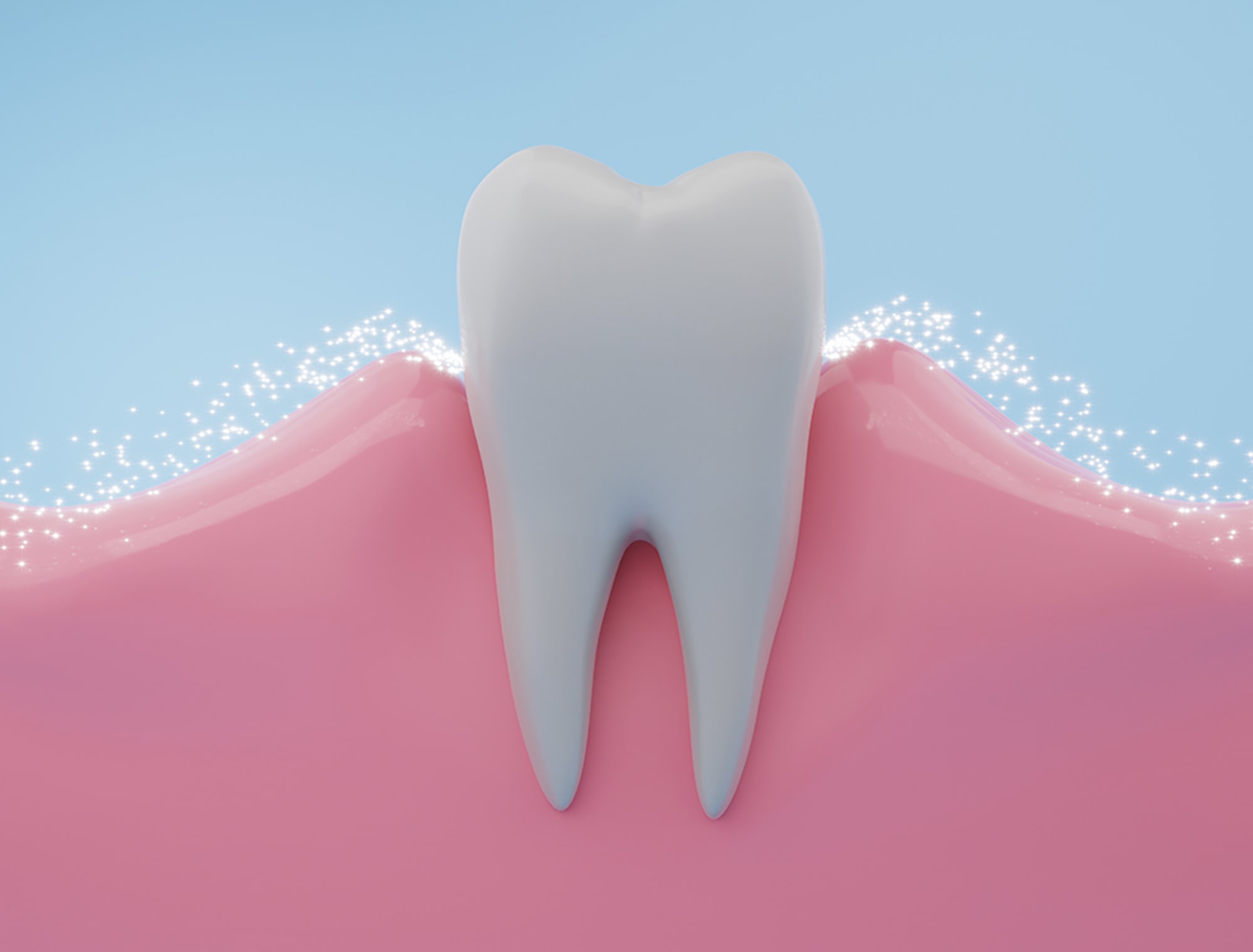 失われた歯周組織の再生